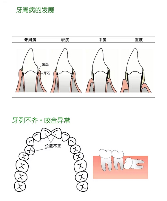 牙齿分类和名称