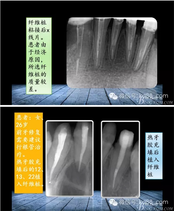 QQ图片20150817140748.png