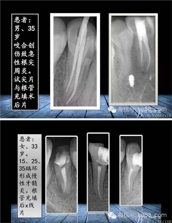 QQ图片20150817140811.png