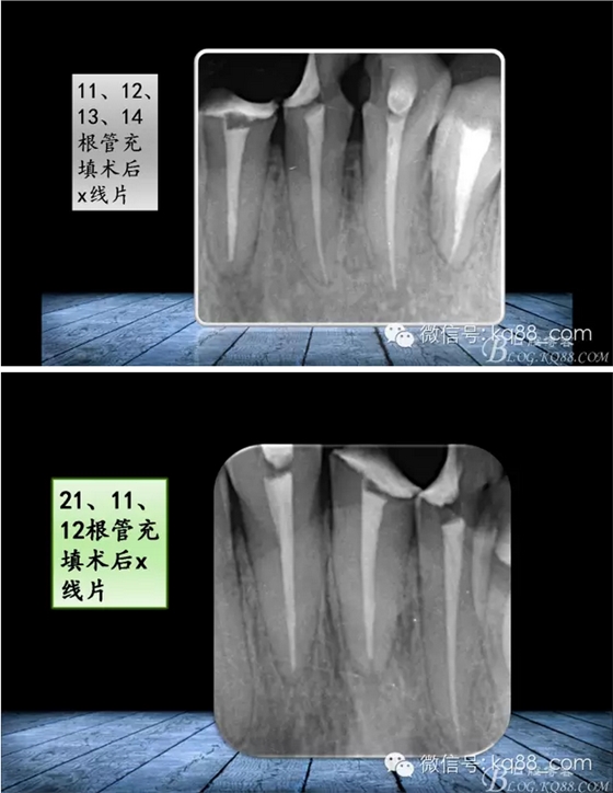 QQ图片20150817141009.png