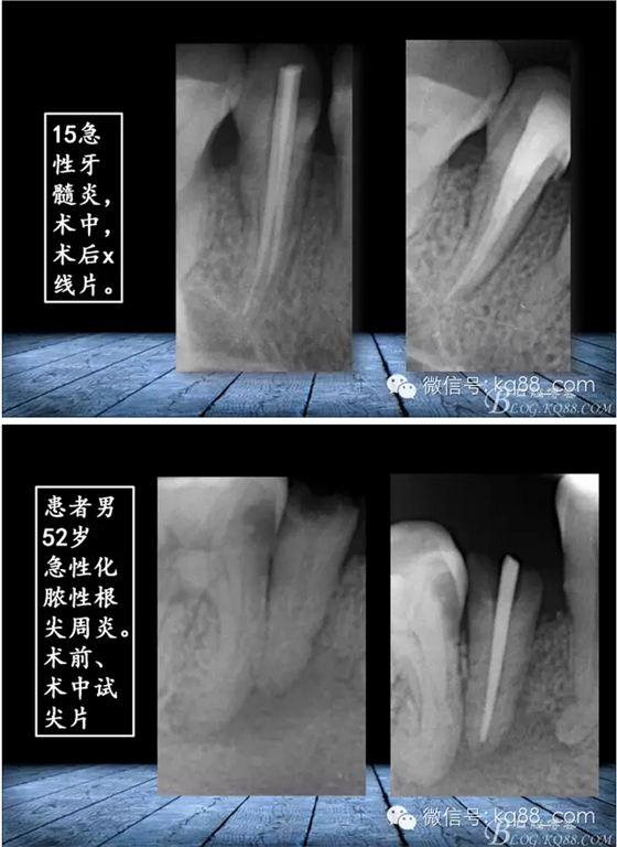 QQ图片20150817141308.png