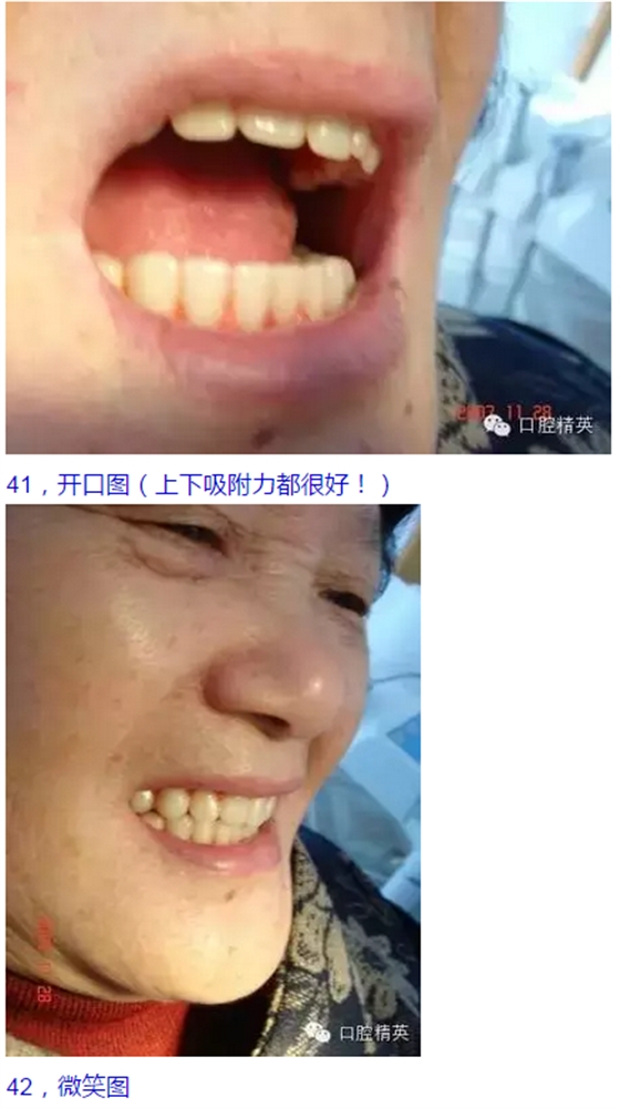 QQ图片20150825104108.png