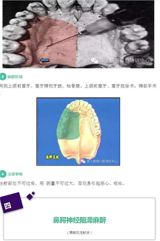 口腔阻滞麻醉方法,注意事项及并发症的处理