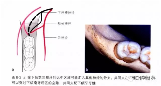 分析局部麻醉失败的常见原因