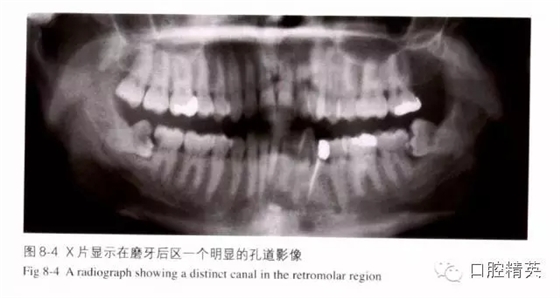 分析局部麻醉失败的常见原因