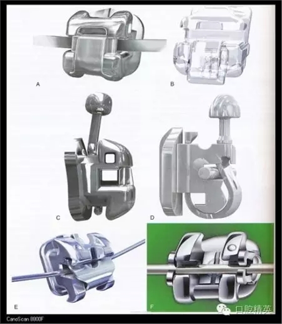 解决牙齿不齐的十八般武器