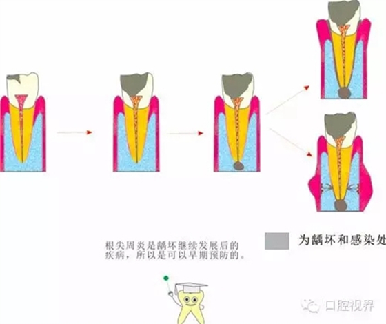 【爱牙科普知识300问】 “什么是牙本质敏感？”