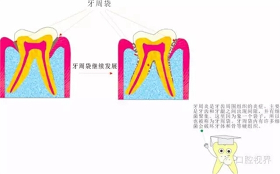 【爱牙科普知识300问】 “什么是牙本质敏感？”