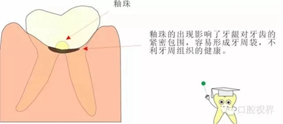 【爱牙科普知识300问】 “什么是融合牙、愈合牙和双生牙？”