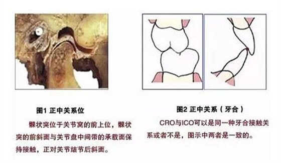 【臻美推荐】现代牙合学概念与全口固定义齿咬合重建