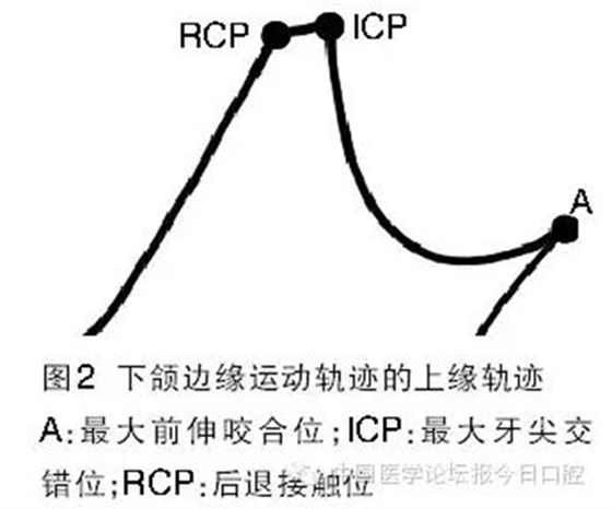 凸凹式后牙咬合接触及其临床意义——王美青教授