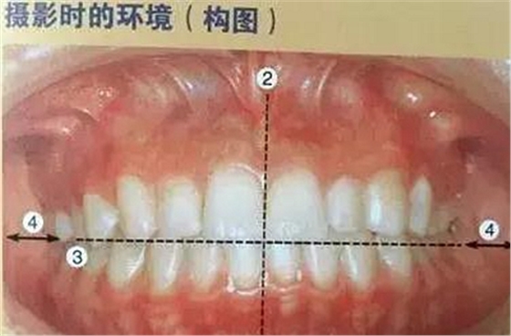 口腔摄影方法与技巧