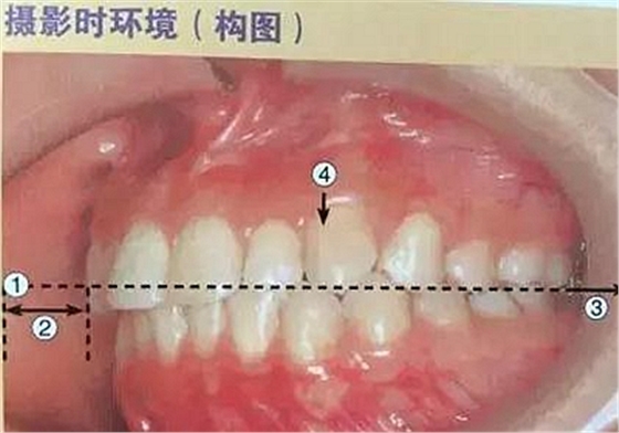 口腔摄影方法与技巧