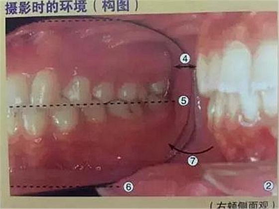 口腔摄影方法与技巧