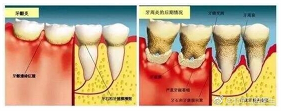 塞牙也是一种病