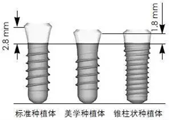 Sraumann种植系统外科操作流程