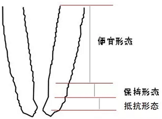 知识分享：规范化根管治疗的细节分析