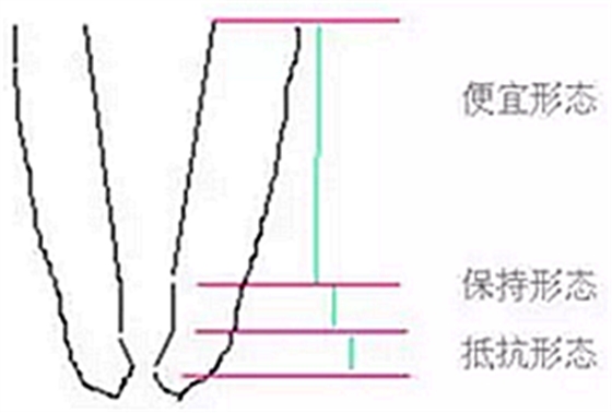 知识分享：根管治疗的标准步骤