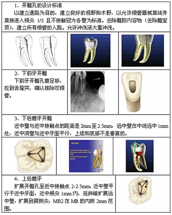 知识分享：根管治疗的标准步骤