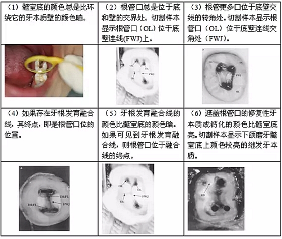 知识分享：根管治疗的标准步骤