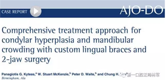 正畸文献赏析--正颌外科学的相关研究