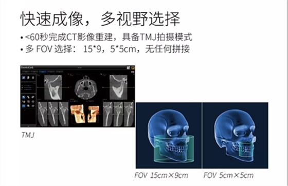 费森影像