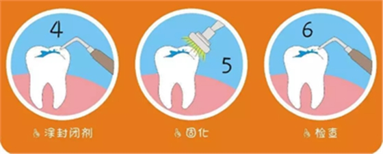 儿童龋病的预防