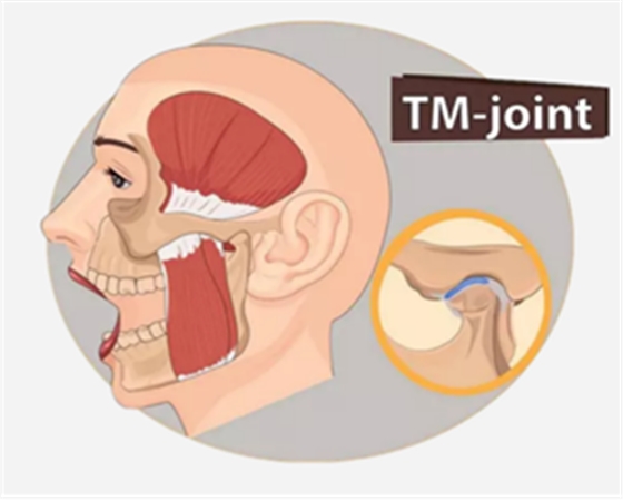 颞下颌关节紊乱病