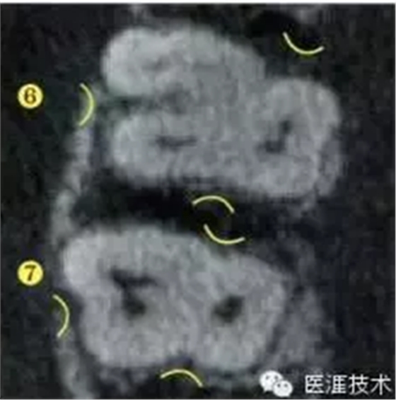 【牙周外科】牙齿的解剖形态（上篇）