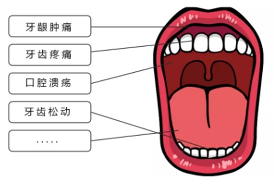 疫情期宅在家，牙齿出问题怎么办？