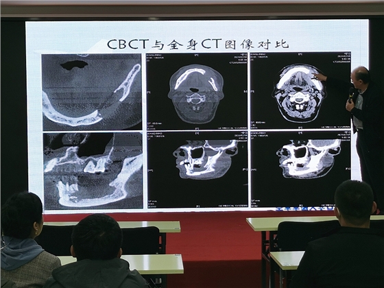 CBCT在口腔颌面部的应用