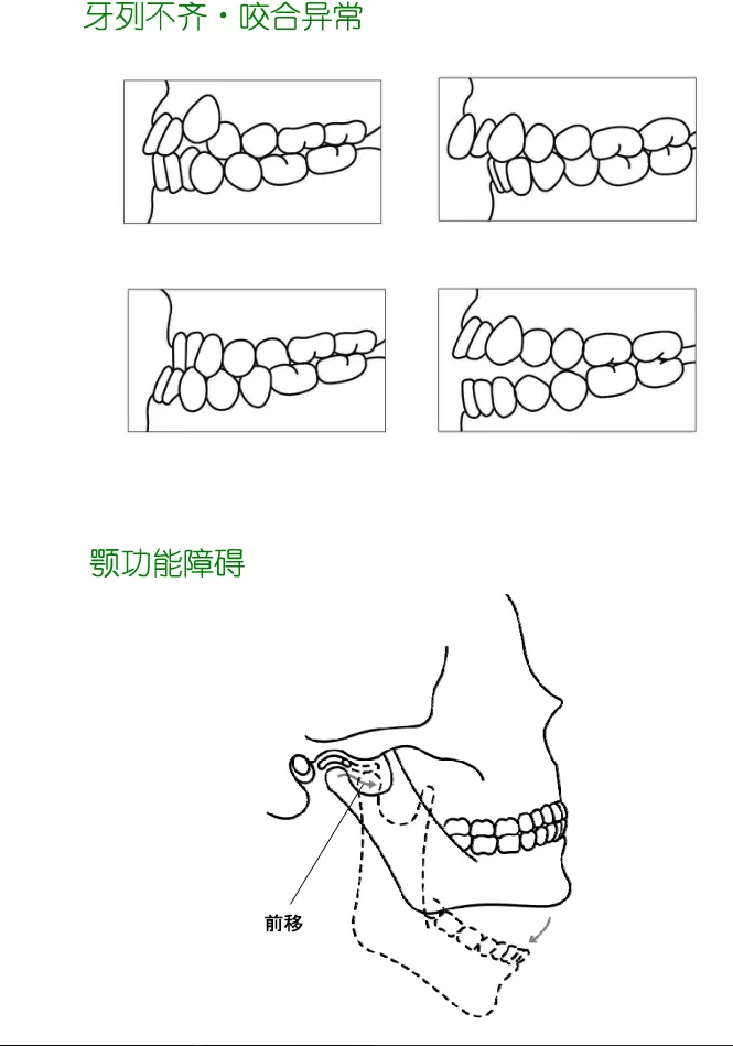 牙齿分类和名称