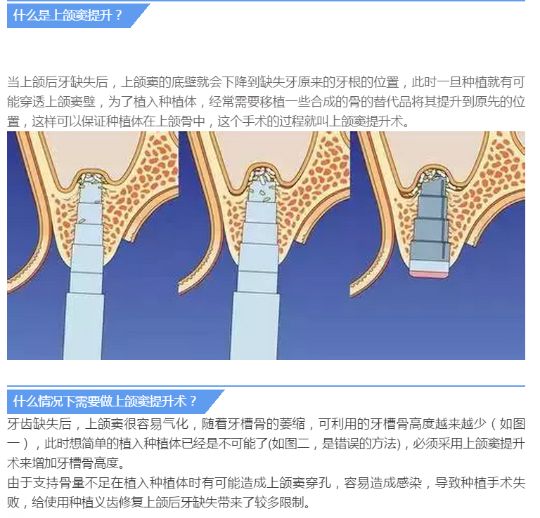 QQ图片20150819100303.png