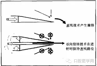 即使是老手也会失手的麻醉----下牙槽、舌、颊一次阻滞麻醉