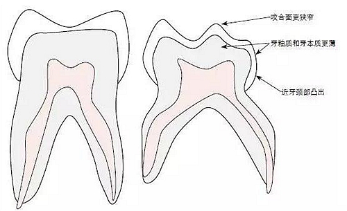 除了乳牙结构的特殊形态特征外,还要考虑到所选充填材料的材料学特性