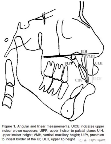 正畸文献阅读--在骨性II、III类开合中上中切牙牙冠暴露量的影响因素
