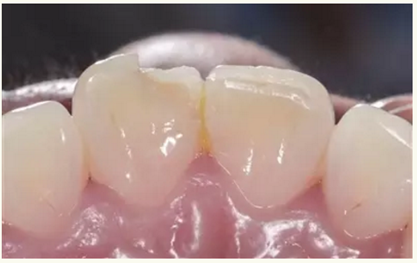显微知著 从齿开始——上海第九人民医院牙体牙髓科
