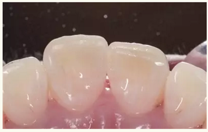 显微知著 从齿开始——上海第九人民医院牙体牙髓科
