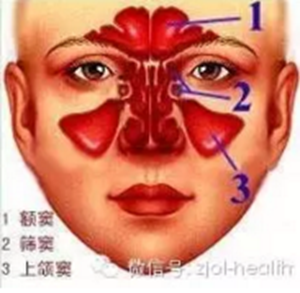 拔牙后引出“偏头痛”！这种情况绝不能置之不理！