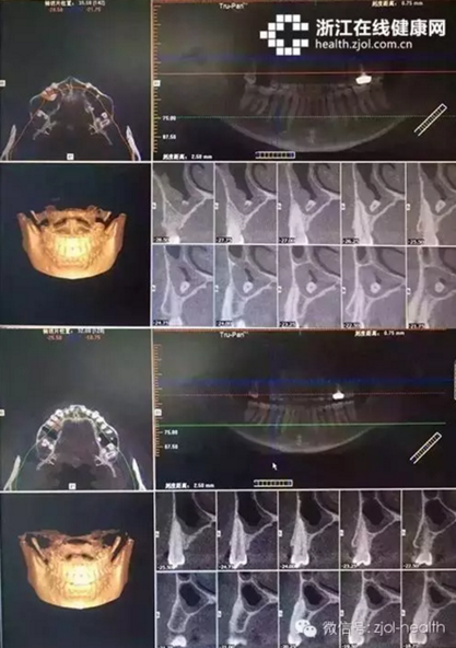 杭州口腔医院城西分院