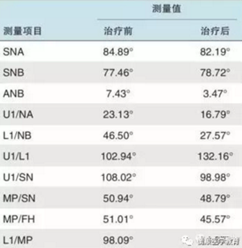 病例精选 | 骨性Ⅱ类高角面型矫治病例