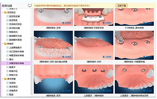 牙科普通前台和优秀前台到底差在哪？