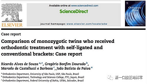 文献优秀正畸病例赏析--同卵双胞胎使用自锁托槽和传统托槽正畸治疗比较