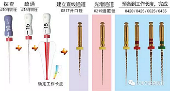 知识分享：根管治疗的标准步骤