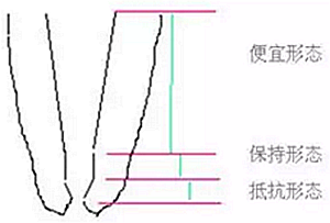 知识分享：根管治疗的标准步骤