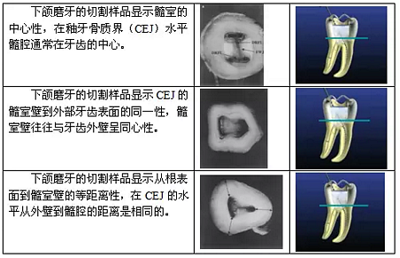 知识分享：根管治疗的标准步骤