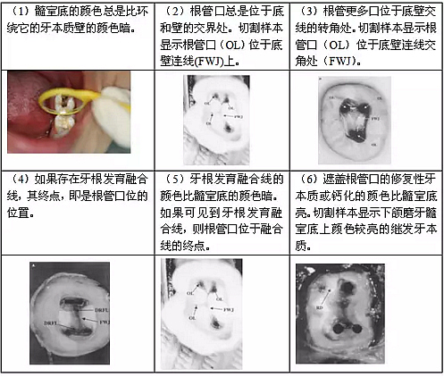 知识分享：根管治疗的标准步骤