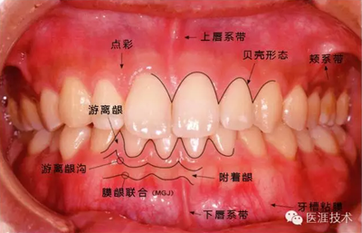 上海品瑞迈格磁致伸缩治疗仪