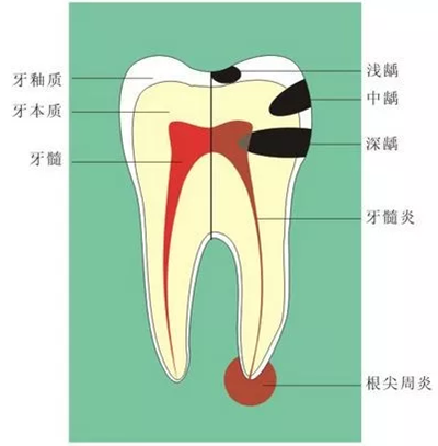 什么是牙龈萎缩？