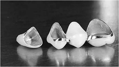 补牙不做冠，疗效少一半！根管治疗后牙齿已经不疼了，为什么还要戴牙冠呢？